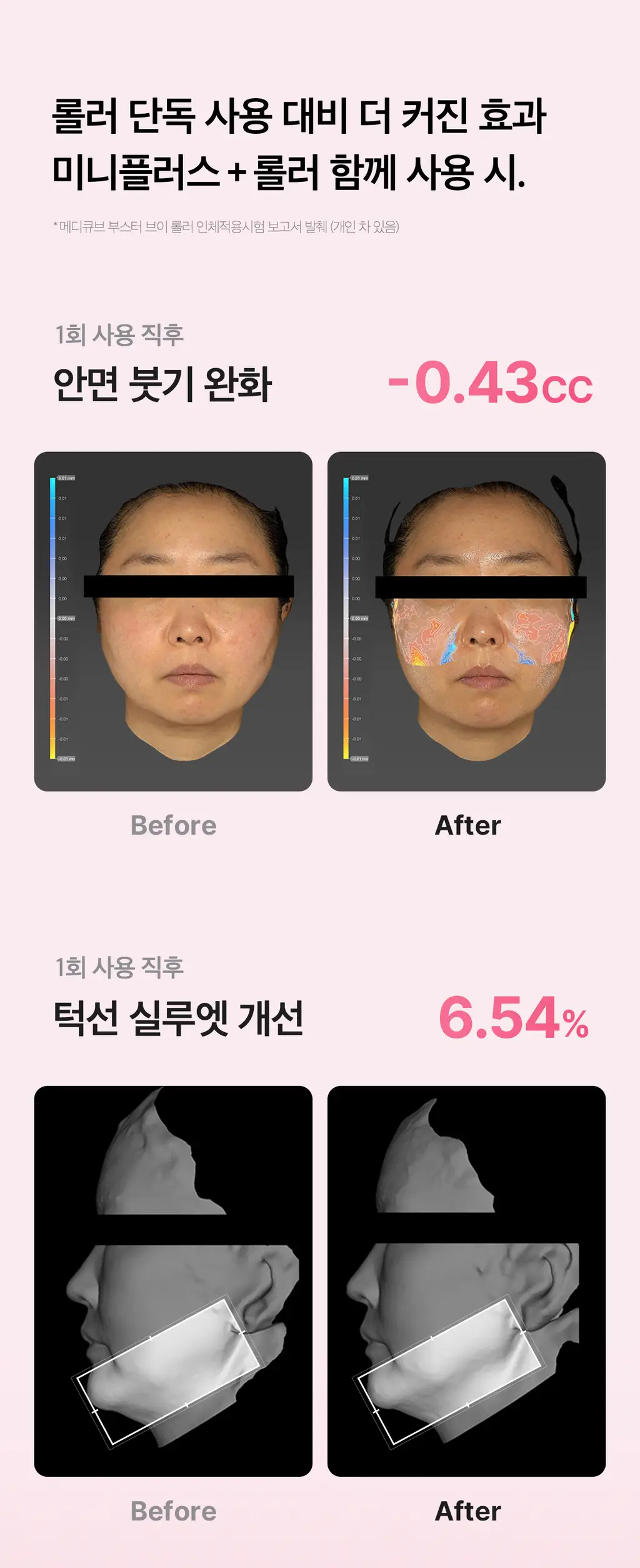 [7월 올영픽][이중턱/윤곽관리] 메디큐브 에이지알 부스터 브이롤러 기획 핑크/베이지 (+미니플러스,브이롤러 헤드) 상세페이지 41